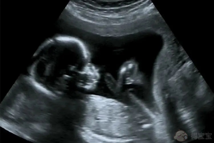 右侧的胎儿是男孩还是女孩？胎儿侧卧时会发生什么？